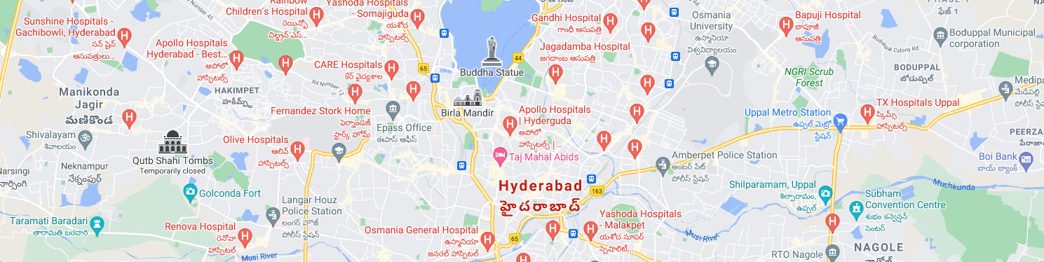 Best uPVC Windows and Doors in Hyderabad